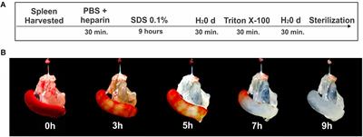 Decellularized Splenic Matrix as a Scaffold for Spleen Bioengineering